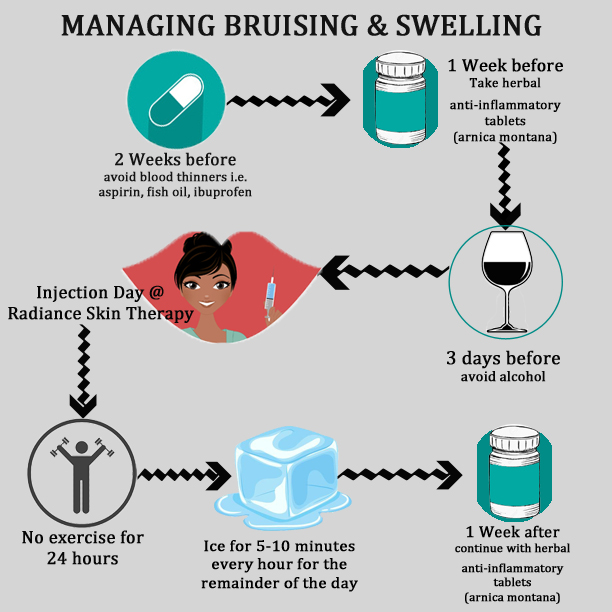 Managing Bruising Swelling
